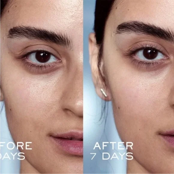 Lancôme Advanced Génifique Serum 30 ml 1 FL OZ New in Box. - Picture 5 of 8